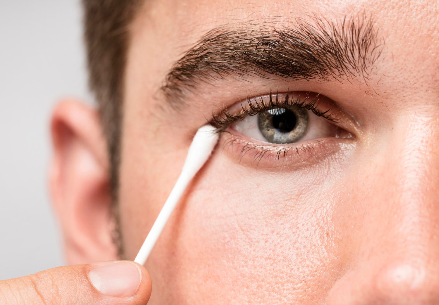 משחת סינטומיצין 3% לעיניים - תרופה עבור דלקות עיניים
