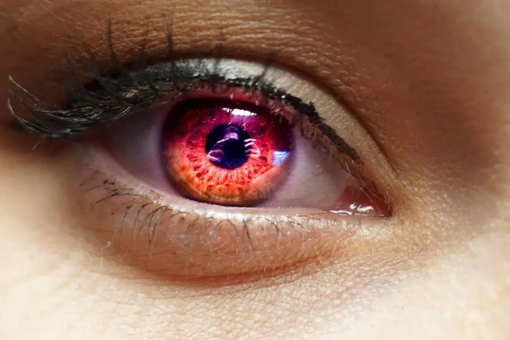 Allergies in the eyes