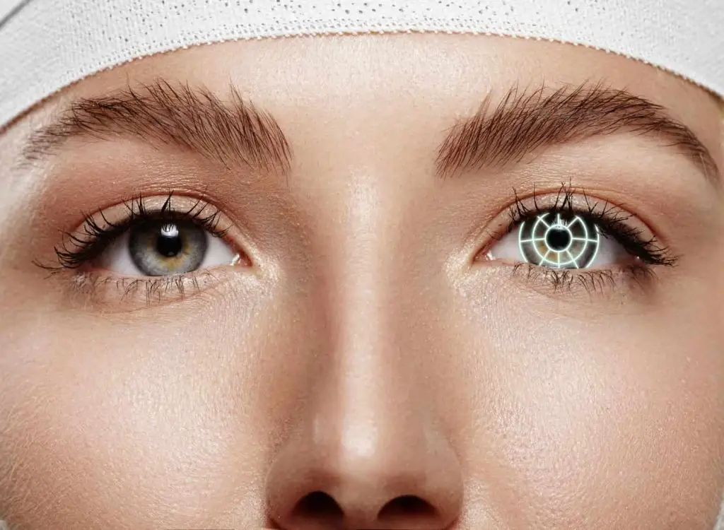Eye color change surgery