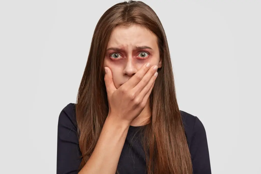 שורף בעיניים